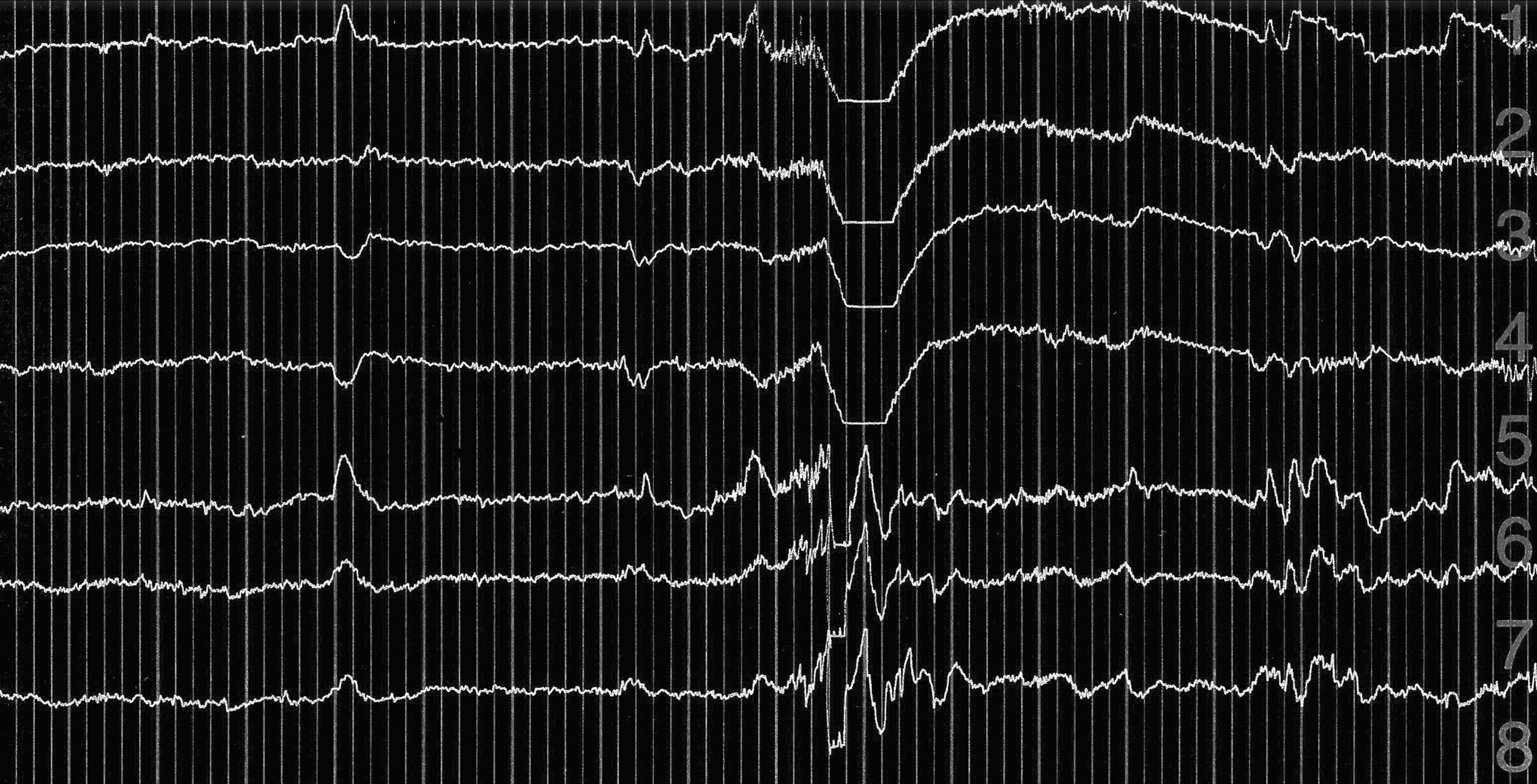 EEG 3 black
